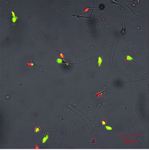 Acridine Orange Staining Of Human Spermatozoa Cells With Red