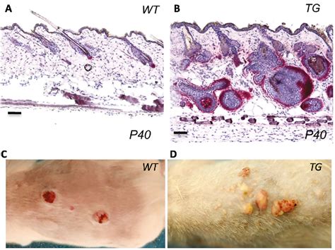 Figure 1 From The Role Of Wnt And Shh Signaling Systems In Noggin