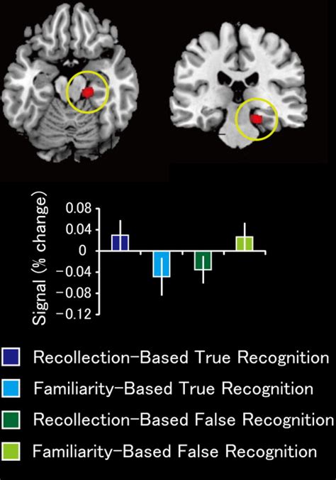 Retrieval Related Activity In The Right Parahippocampal Gyrus The