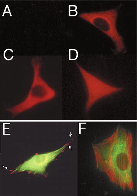 Immunofluorescence Analysis Of NIH 3T3 Fibroblasts Expressing Ajuba