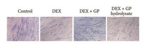 Gp Reduces Dex Induced C C Myotube Atrophy A Representative