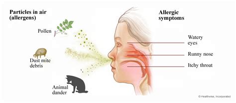 What are allergies? - ENT Clinic