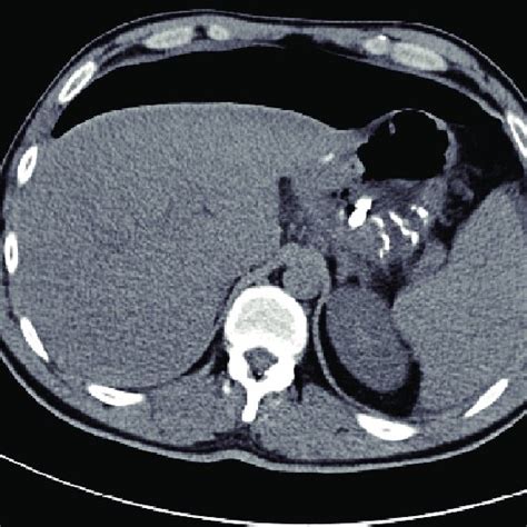 X-ray examination: barium sulphate was used as contrast agent. Repeated ...