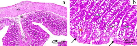 Photomicrographs Of A Colonic Section From Group Iii Recovery Group Download Scientific