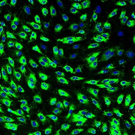 Human Dermal Microvascular Endothelial Cells Innoprot Dermal Cells