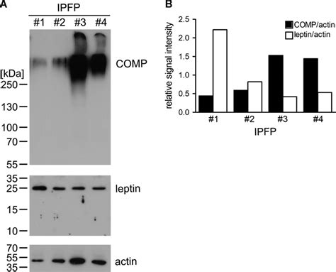 Immunoblot Analysis Of Cartilage Oligomeric Matrix Protein COMP