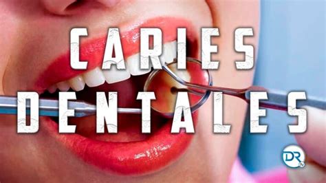 Identificaci N Y Tratamiento De Los S Ntomas De Caries Dentales