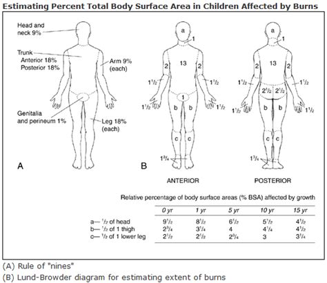 Burns Assessment Teachmepaediatrics