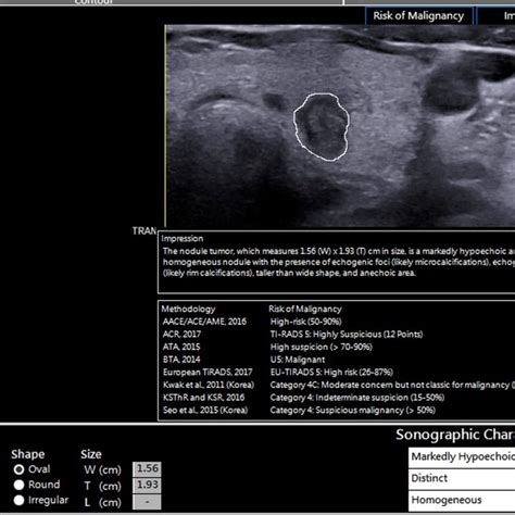 Representative images of TI-RADS and ATA systems in thyroid nodules. A:... | Download Scientific ...