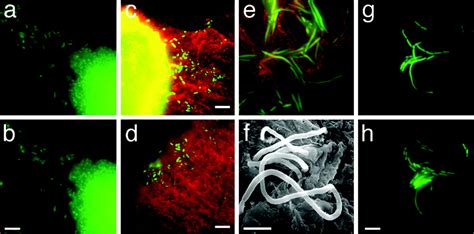 Differentiation And Developmental Pathways Of Uropathogenic Escherichia Coli In Urinary Tract