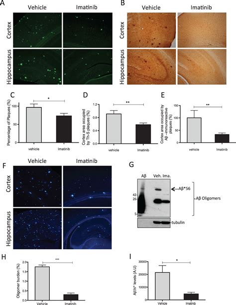 Reduction of Blood Amyloid β Oligomers in Alzheimers Disease