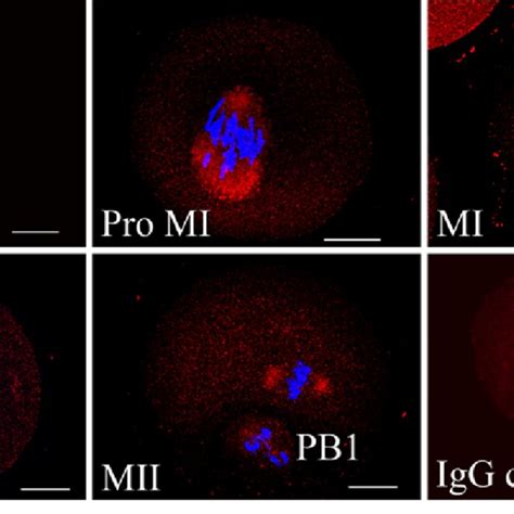 Subcellular Localization Of Whamm During Mouse Oocyte Meiotic