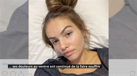 Opérée de deux kystes ovariens Thylane Blondeau révèle son calvaire