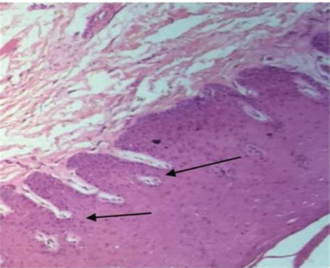 Histological Sections Of The Buccal Mucosa A Histological Section Of