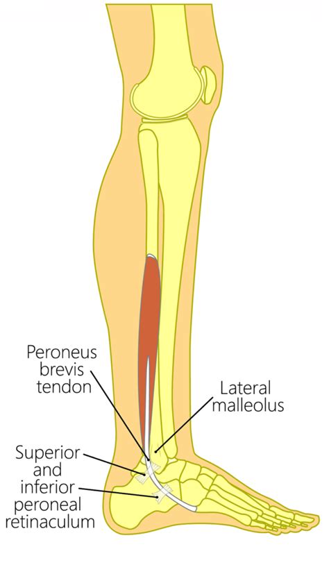 Peroneus Brevis Tears & Tendonitis [FIX Peroneus Brevis Tendon Pain!]