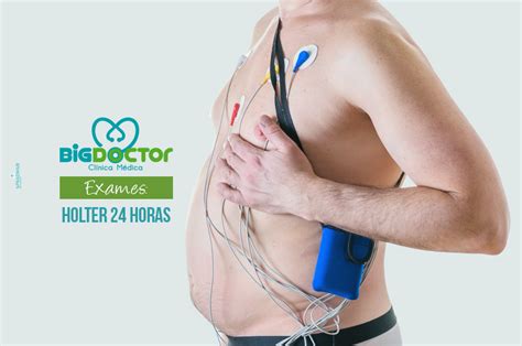 Exames Holter Horas Cl Nica Big Doctor