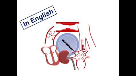 Esc Guidelines 4 Preoperative Consultation For Specific Cvd English