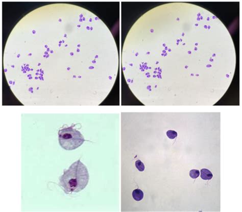 Individual Protists Pictures Flashcards Quizlet