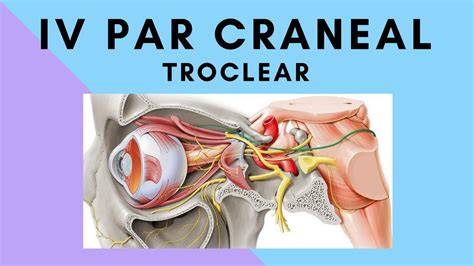 IV Par Craneal Troclear Ritmo Medico UDocz