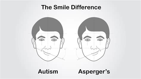 The Smile Difference Autism Vs Asperger Syndrome Youtube