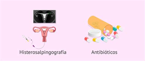 Diagnóstico Y Tratamiento De La Salpingitis