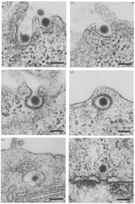 Micrographs From Tem Experiments Showing Cells Which Had Been