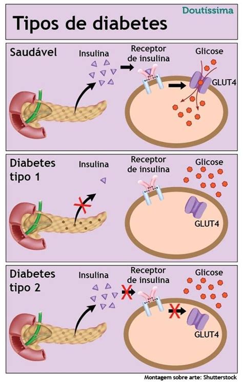 Tabela De Glicose