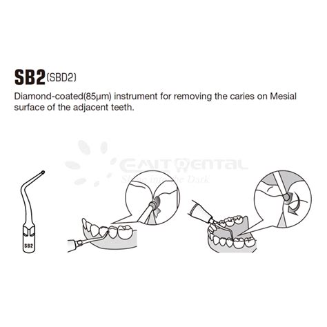 Cavity Preparation Scaling Tip SBD2 For SATELEC Buy Cavity