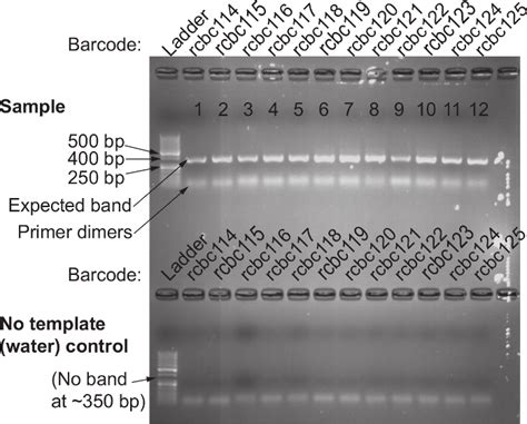 Confirmation Of Successful S Rrna Gene Amplification Using The F