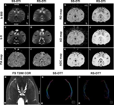 Frontiers Performance Of Single Shot Echo Planar Imaging In Diffusion