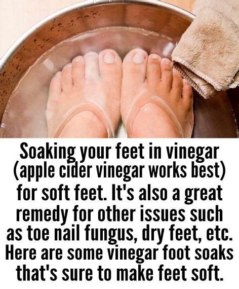 Apple Cider Vinegar For Soft Feet Diy Beauty Tips