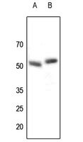 Rabbit anti Parkin Polyclonal Antibody 爱必信 absin 官网