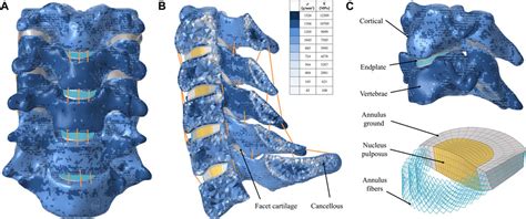 Frontiers Biomechanical Evaluation Of A Novel Individualized Zero