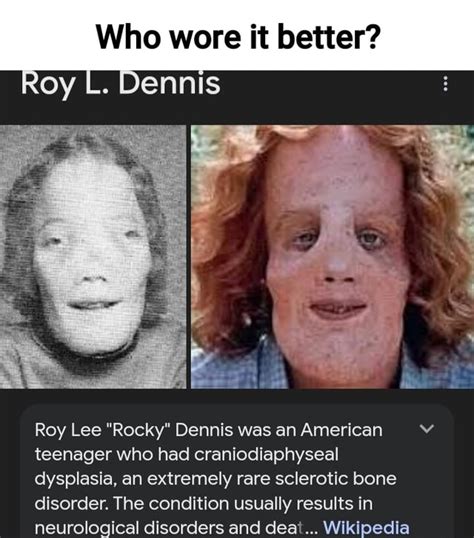 Who Wore It Better Roy L Dennis Roy Lee Rocky Dennis Was An