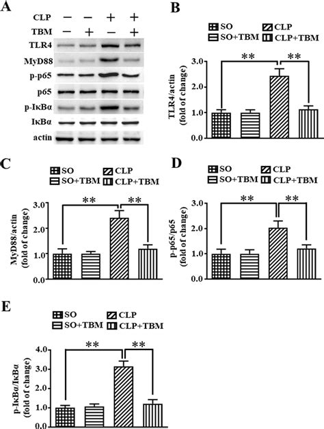 Tbm Inhibits Clp Activated Tlr4 Myd88 Nf κb Pathway In Vivo Wild Type