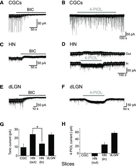 Characterizing GABA A Receptor Mediated Tonic And 4 PIOL Activated