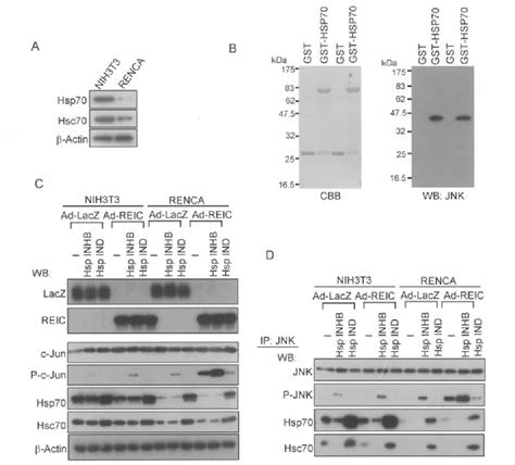 Figure 4 From Heat Shock Proteins Play A Crucial Role In Tumor Specific