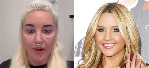 Amanda Bynes Reveals Drastic Plastic Surgery Removing Skin Folds From