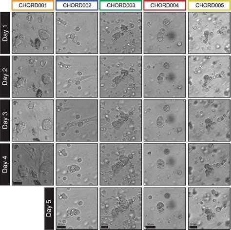 Morphology Of The Pdos Established As Visualized By Brightfield Imaging