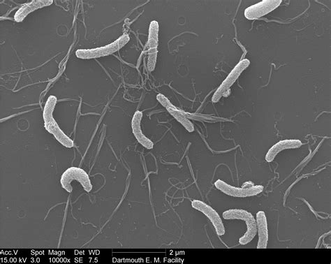 Vibrio Cholerae Comma Bacillus Curved Bacilli Singly Comma Shape