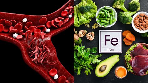 Health and Wellness: Understanding Iron Deficiency: Symptoms, Causes ...