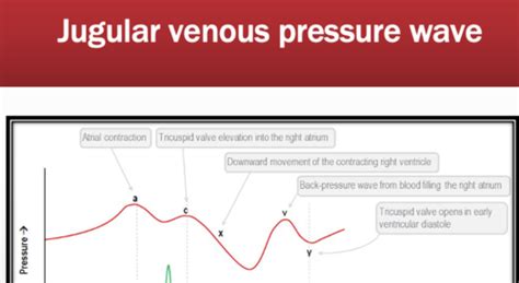 Surgery 2 Exam 1 Critical Care And Hemodynamics Flashcards Quizlet