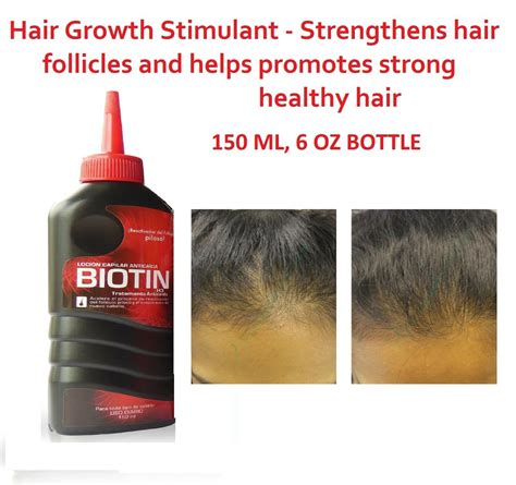 Hair Growth Intesive Biotin Hair Regrowth Treatment Tonic 150 ML Loción ...