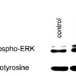 The MEK Inhibitor U0126 Completely Abolishes ERK1 2 Phosphorylation But