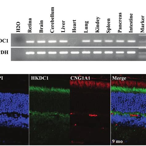 Expression And Localization Of HKDC1 In The Mouse Retina A Reverse