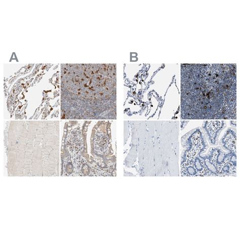 CapG Antibody NBP1 90215 Novus Biologicals