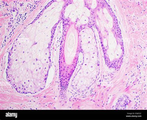 H E Stain Light Microscopy Normal Hair Follicle Stock