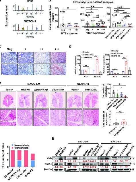 Abnormal Expression Of Both Notch And Myb Cooperatively Promotes The