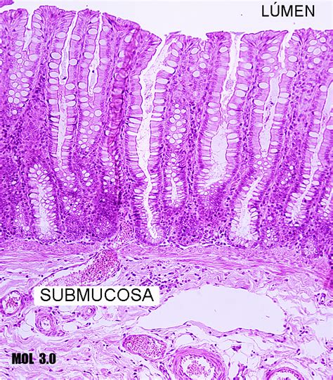 Histologia Dos Sistemas Intestino Grosso Images And Photos Finder