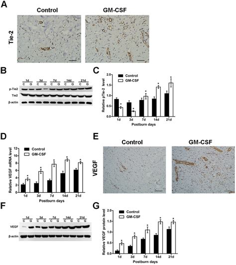 Tie Protein Levels Tyrosine Phosphorylation And Vegf Expression In